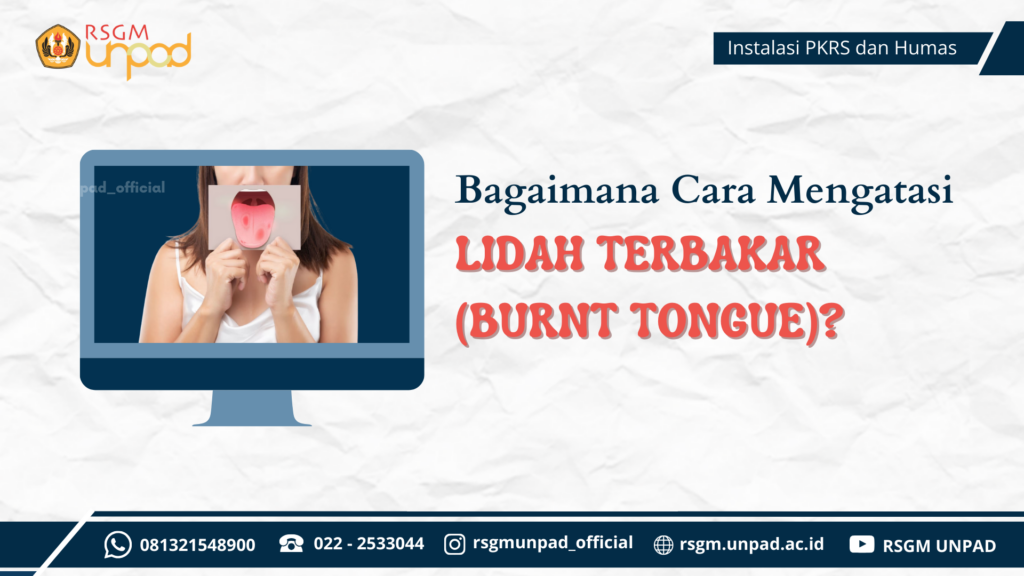 Bagaimana Cara Mengatasi Lidah terbakar (burnt tongue)?