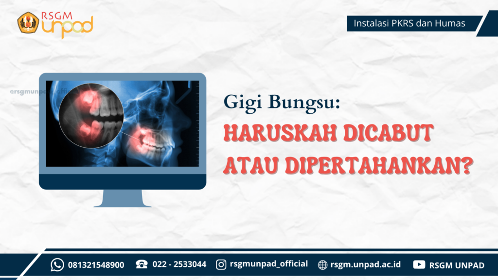 GIGI BUNGSU: Haruskah Dicabut atau Dipertahankan?