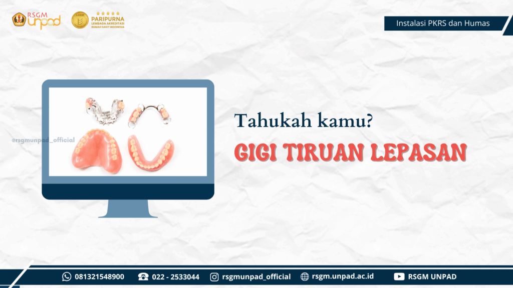 APA ITU GIGI TIRUAN LEPASAN?