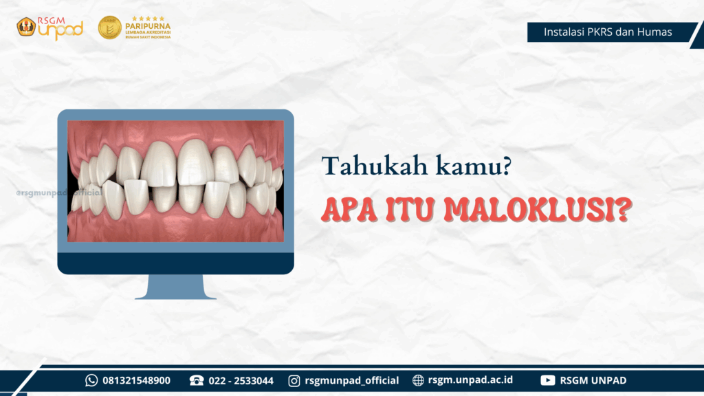 APA ITU MALOKLUSI?